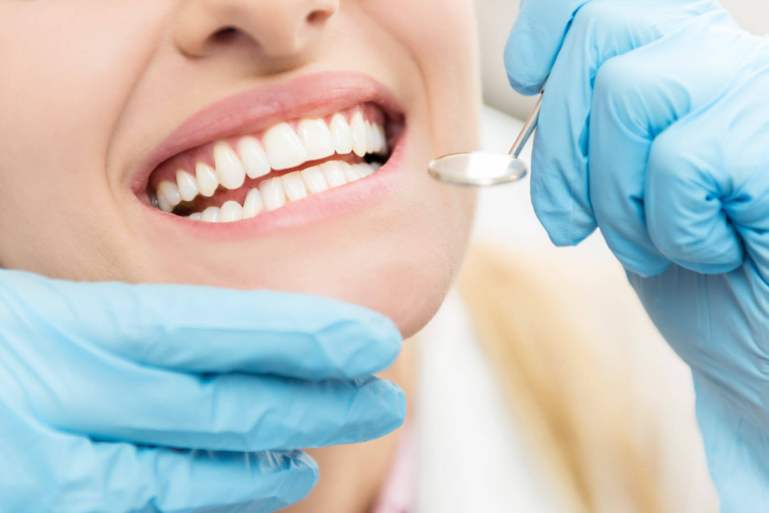 Closeup of a woman's smile after receiving a deep cleaning in Wolcott, CT