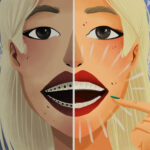Graphic illustration of woman smiling comparing Invisalign vs. traditional braces.