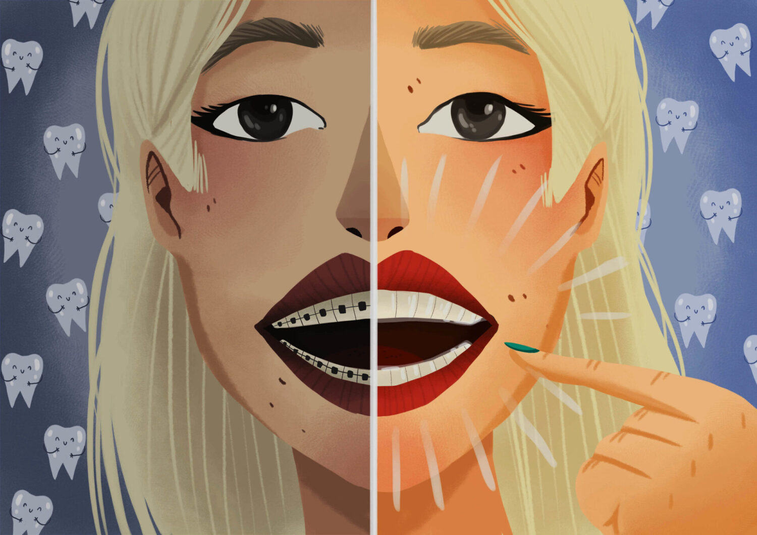 Graphic illustration of woman smiling comparing Invisalign vs. traditional braces.